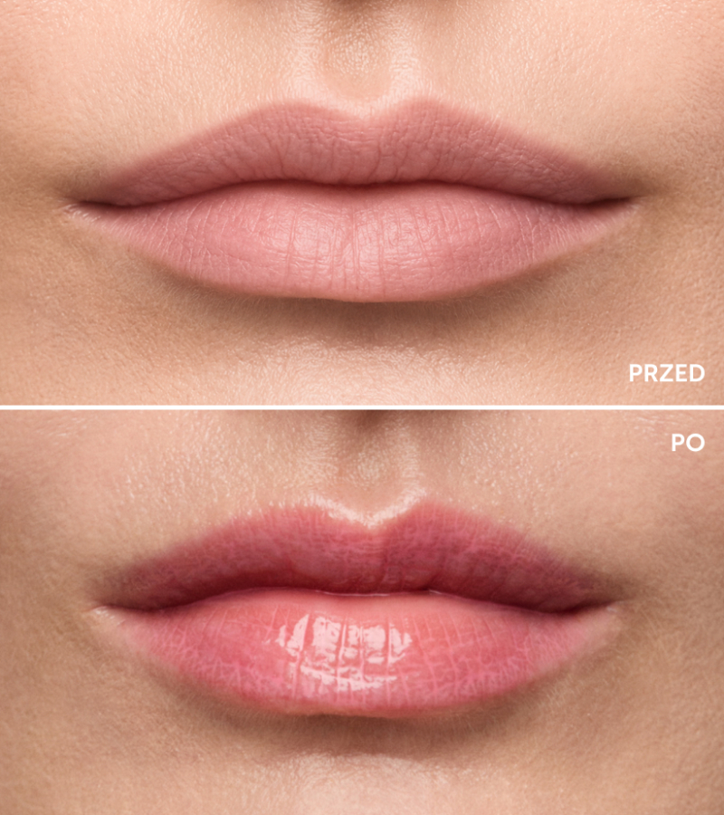 Lips On serum-błyszczyk do ust strawberry pink